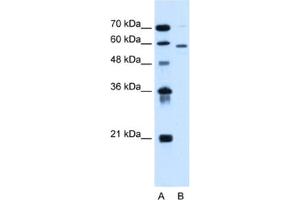Western Blotting (WB) image for anti-Asparagine-Linked Glycosylation 11, alpha-1,2-Mannosyltransferase Homolog (Yeast) (ALG11) antibody (ABIN2462823) (ALG11 Antikörper)