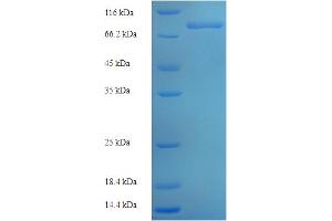 SDS-PAGE (SDS) image for Zinc Finger Protein 155 (ZNF155) (AA 1-538), (full length) protein (His-SUMO Tag) (ABIN5710644)