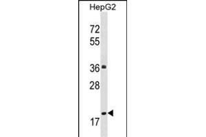M1M Antibody (Center) (ABIN1537819 and ABIN2848601) western blot analysis in HepG2 cell line lysates (35 μg/lane). (PPM1M Antikörper  (AA 130-158))