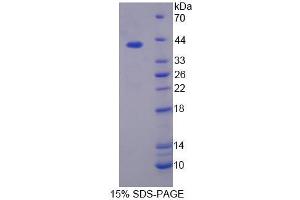 SDS-PAGE analysis of Rat PLSCR4 Protein. (PLSCR4 Protein)