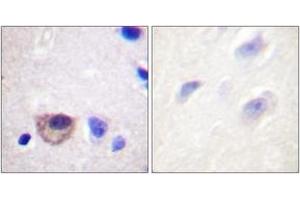 Immunohistochemistry analysis of paraffin-embedded human brain tissue, using ATPase (Ab-16) Antibody.