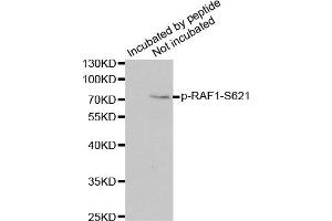 Western Blotting (WB) image for anti-V-Raf-1 Murine Leukemia Viral Oncogene Homolog 1 (RAF1) (pSer621) antibody (ABIN3019551) (RAF1 Antikörper  (pSer621))