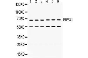 Anti- ERV31 antibody, Western blotting All lanes: Anti ERV31  at 0. (ERV3 Antikörper  (C-Term))