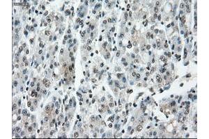 Image no. 19 for anti-P450 (Cytochrome) Oxidoreductase (POR) antibody (ABIN1497746) (POR Antikörper)