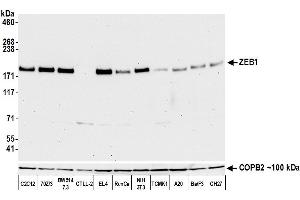 Western Blotting (WB) image for anti-Zinc Finger E-Box Binding Homeobox 1 (ZEB1) (AA 1074-1124) antibody (ABIN7453320)
