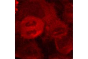 Immunofluorescence staining of methanol-fixed Hela cells using Phospho-MAP2K2-T394 antibody.