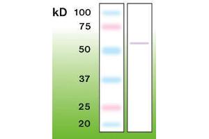 Western Blotting (WB) image for anti-Tumor Protein P53 (TP53) (C-Term) antibody (ABIN870298) (p53 Antikörper  (C-Term))