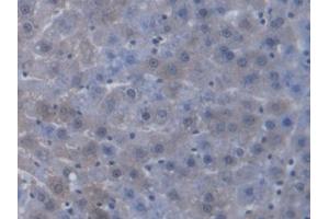 DAB staining on IHC-P; Samples: Rat Liver Tissue (TAP2 Antikörper  (AA 467-703))