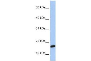 C9ORF46 antibody used at 1 ug/ml to detect target protein. (PLGRKT Antikörper  (Middle Region))