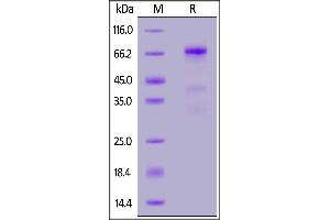 SDS-PAGE (SDS) image for Glypican 3 (GPC3) (AA 25-559) (Active) protein (His tag,AVI tag,Biotin) (ABIN5954920)