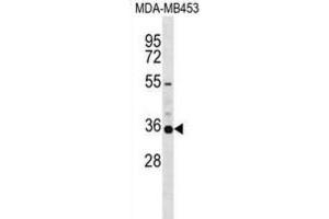 Western Blotting (WB) image for anti-Potassium Voltage-Gated Channel, Shaker-Related Subfamily, Member 5 (KCNA5) antibody (ABIN2999168) (KCNA5 Antikörper)