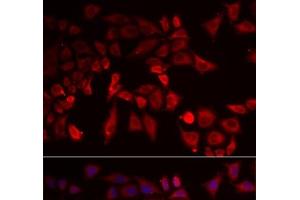 Immunofluorescence analysis of MCF-7 cells using PYGL Polyclonal Antibody (PYGL Antikörper)