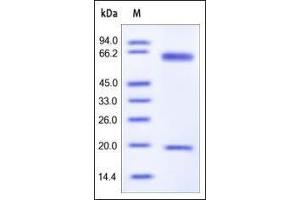 Mouse PCSK9, His Tag on SDS-PAGE under reducing (R) condition.