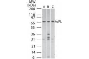 Image no. 1 for anti-Interleukin 18 Receptor Accessory Protein (IL18RAP) (AA 50-100) antibody (ABIN199977) (IL18RAP Antikörper  (AA 50-100))