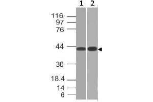 Image no. 1 for anti-Cytokine Receptor-Like Factor 2 (CRLF2) (AA 97-252) antibody (ABIN5027607) (CRLF2 Antikörper  (AA 97-252))