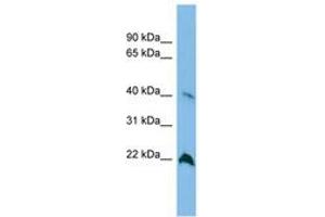 Image no. 1 for anti-TDP-Glucose 4,6-Dehydratase (TGDS) (AA 143-192) antibody (ABIN6745075) (TGDS Antikörper  (AA 143-192))