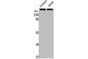 Western Blot analysis of Jurkat A549 cells using MRP7 Polyclonal Antibody (ABCC1 Antikörper  (Internal Region))