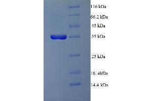 SDS-PAGE (SDS) image for Protein Phosphatase 2A 48 KDa Regulatory Subunit (PPP2R3B) (AA 1-176) protein (His-SUMO Tag) (ABIN5711985)