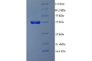 SDS-PAGE (SDS) image for Protein Phosphatase 2A 48 KDa Regulatory Subunit (PPP2R3B) (AA 1-176) protein (His-SUMO Tag) (ABIN5711985) (PPP2R3B Protein (AA 1-176) (His-SUMO Tag))