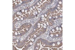 Immunohistochemical staining of human small intestine with MTCH2 polyclonal antibody  shows moderate cytoplasmic positivity in glandular cells. (MTCH2 Antikörper)