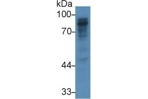 Detection of PIGR in Rat Liver lysate using Polyclonal Antibody to Polymeric Immunoglobulin Receptor (PIGR) (PIGR Antikörper  (AA 463-563))