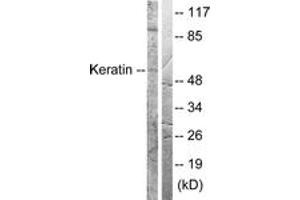 Western blot analysis of extracts from HeLa cells, treated with Anisomycin 25ug/ml 30', using Keratin 8 (Ab-73) Antibody. (KRT8 Antikörper  (AA 41-90))