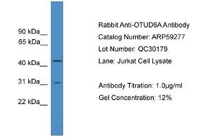 WB Suggested Anti-OTUD6A  Antibody Titration: 0. (OTUD6A Antikörper  (Middle Region))
