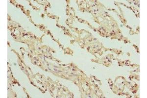 Immunohistochemistry of paraffin-embedded human lung tissue using ABIN7154146 at dilution of 1:100 (GLYCTK Antikörper  (AA 284-523))