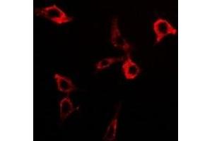 Immunofluorescent analysis of PDC-E2 staining in Hela cells. (DLAT Antikörper)