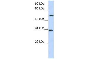 Western Blot showing ZNF138 antibody used at a concentration of 1-2 ug/ml to detect its target protein.