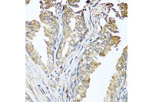 Immunohistochemistry of paraffin-embedded human prostate using STK3 antibody. (STK3 Antikörper  (AA 323-450))