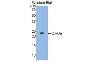 Western Blotting (WB) image for anti-Vanin 1 (VNN1) (AA 36-223) antibody (ABIN1175767) (VNN1 Antikörper  (AA 36-223))