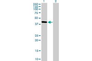 Western Blot analysis of FBXO31 expression in transfected 293T cell line by FBXO31 MaxPab polyclonal antibody. (FBXO31 Antikörper  (AA 1-367))