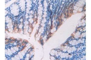 Used in DAB staining on fromalin fixed paraffin- embedded stomach tissue