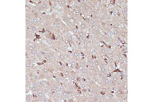 Immunohistochemistry of paraffin-embedded human liver using HLA-DRA antibody (ABIN6131757, ABIN6141827, ABIN6141829 and ABIN6215475) at dilution of 1:100 (40x lens). (HLA-DRA Antikörper  (AA 26-216))