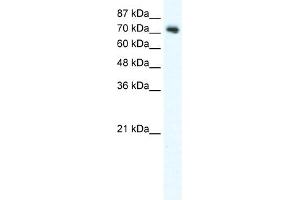 WB Suggested Anti-DVL1 Antibody Titration:  2. (DVL1 Antikörper  (C-Term))