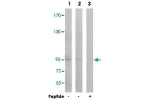 Western blot analysis of extracts from Jurkat cells (Lane 1) and COLO cells (Lane 2 and 3), using GRIA1 polyclonal antibody . (Glutamate Receptor 1 Antikörper)