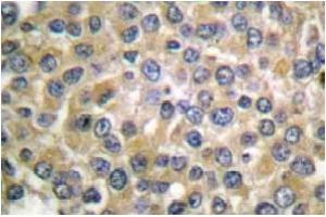 Image no. 1 for anti-Melan A (MLANA) antibody (ABIN265512) (MLANA Antikörper)