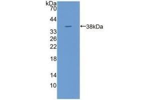 TPP1 Antikörper  (AA 1-320)