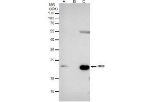 IP Image Bid antibody [N1C3] immunoprecipitates BID protein in IP experiments. (BID Antikörper)