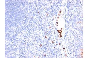 Formalin-fixed, paraffin-embedded human Tonsil stained with MYADM Mouse Monoclonal Antibody (MYADM/971). (MYADM Antikörper)