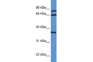 WB Suggested Anti-DHPS AntibodyTitration: 1. (DHPS Antikörper  (N-Term))