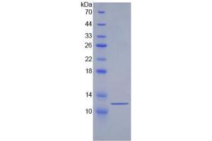 SDS-PAGE analysis of Human HSPA8 Protein. (Hsc70 Protein)