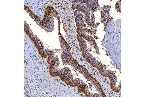 IHC analysis of TRMT61A using anti-TRMT61A antibody (ABIN7599220).