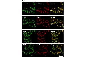 Vesicular nucleotide transporter (VNUT) was present in the dense granules of human platelets. (LAMP1 Antikörper)