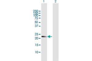 Western Blot analysis of AMN1 expression in transfected 293T cell line by AMN1 MaxPab polyclonal antibody. (AMN1 Antikörper  (AA 1-213))