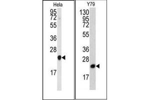 Image no. 1 for anti-Phosphatidylethanolamine Binding Protein 1 (PEBP1) (N-Term) antibody (ABIN360563) (PEBP1 Antikörper  (N-Term))