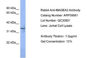 WB Suggested Anti-MAGEA2  Antibody Titration: 0. (MAGEA2 Antikörper  (N-Term))