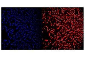 IF analysis of RCC1 using anti-RCC1 antibody (ABIN7600024).