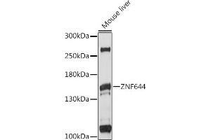 Western blot analysis of extracts of mouse liver, using ZNF644 antibody (ABIN7271515) at 1:1000 dilution. (ZNF644 Antikörper  (AA 1-300))